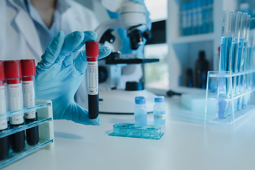 Panel biomarkerów osocza do wczesnego wykrywania choroby Alzheimera